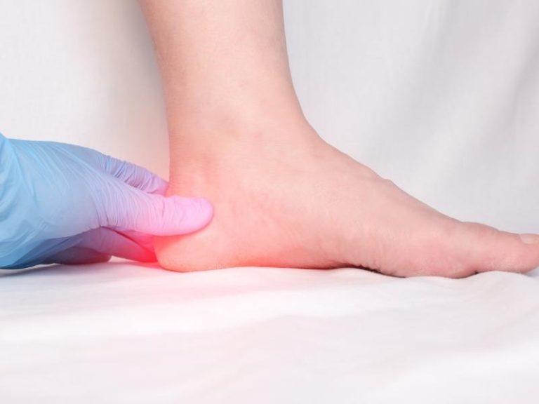 Fascitis plantar qué es, síntomas, tratamientos y causas Farmacia Moyano